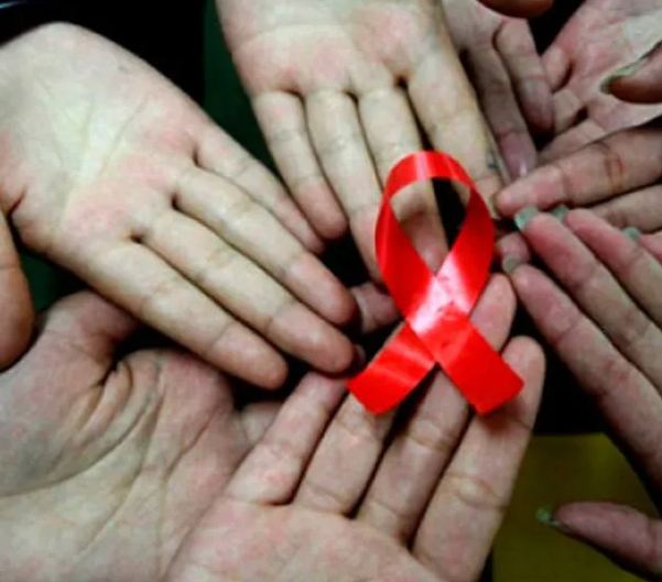 How HIV manifests in women How to prevent, and care for, infection