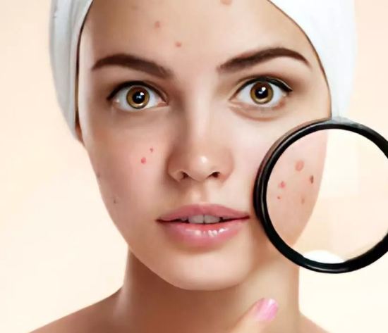 The easiest way to remove facial scars, acne marks