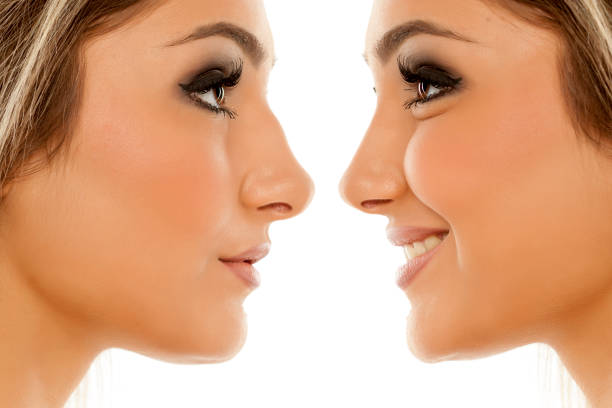 Must see to make thick nose thinner and better shape