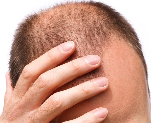 to-remove-hair-fall-and-baldness-do-balayam-see-how-to-do-it बालायाम