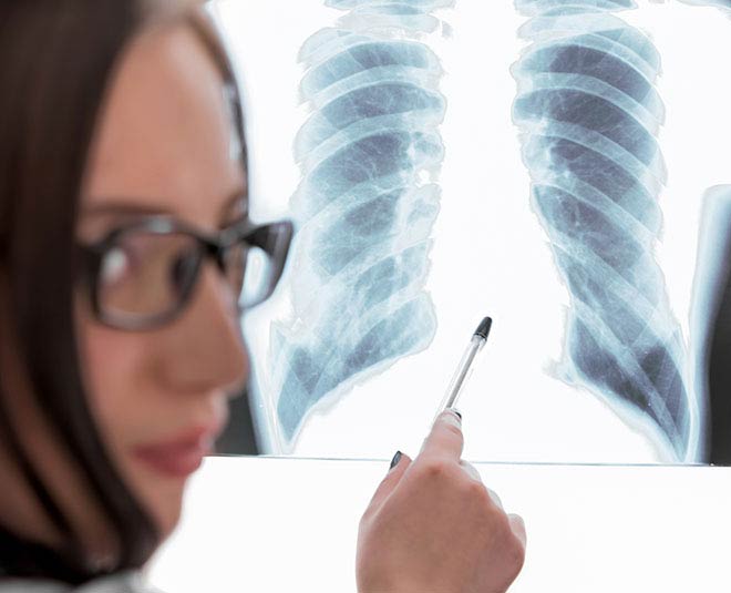 Do not ignore these symptoms of lung, know what are the early symptoms of cancer?
